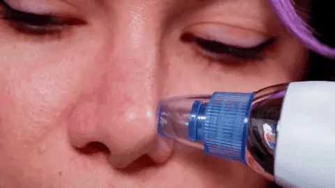 Aspiratore punti neri BlackHead